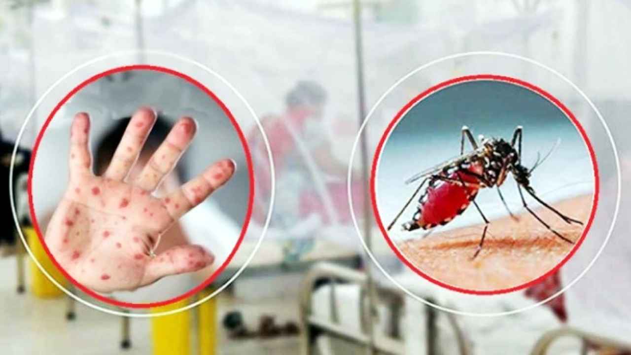 ডেঙ্গু ও হাম উপসর্গে আরও ৫ শিশুর মৃত্যু