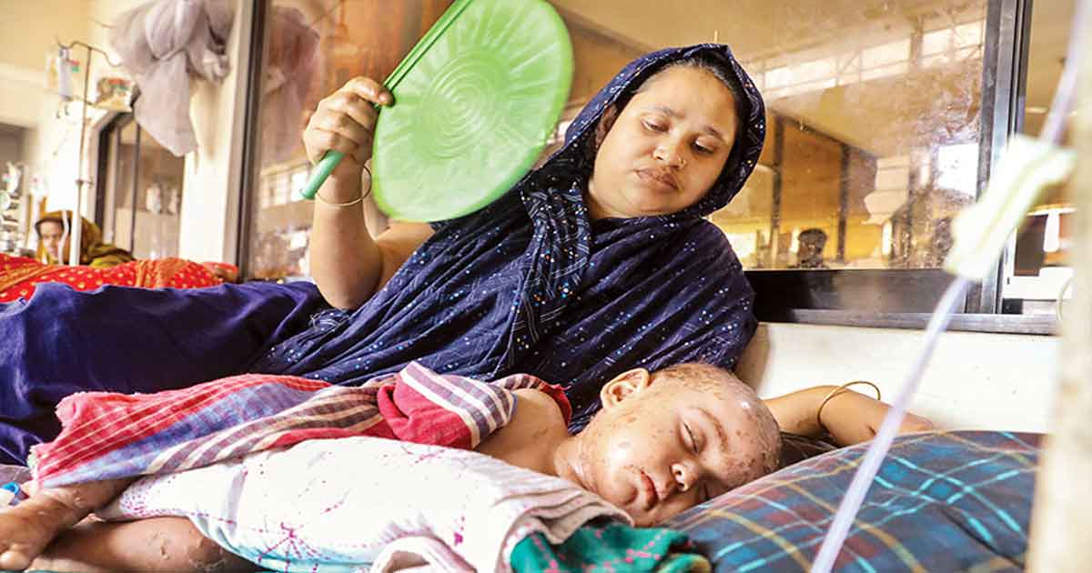 হাম উপসর্গে প্রাণ গেল আরও ৬ জনের