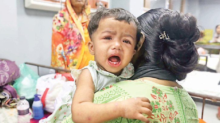 হাম ও উপসর্গে আরও ৩ শিশুর মৃত্যু