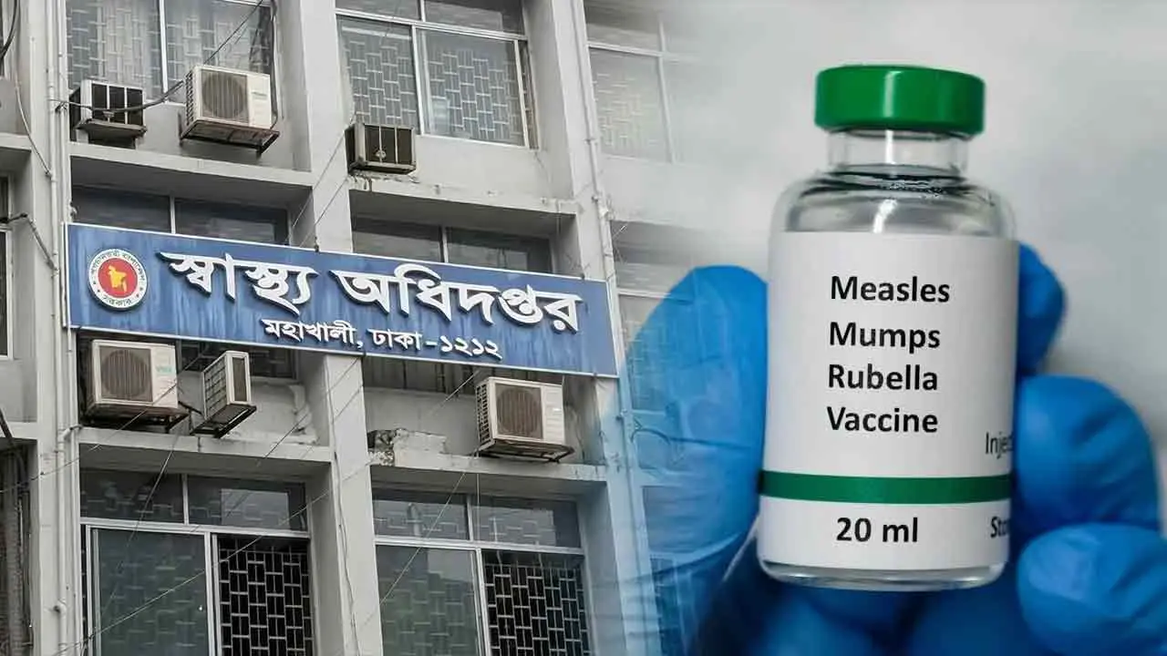 হাম ও উপসর্গে আরও ৭ জনের মৃত্যু, আক্রান্ত ১১৯৪