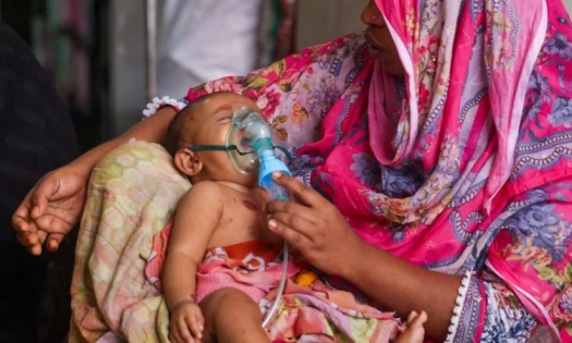 হাম উপসর্গে ৭ জনের মৃত্যু, হাসপাতালে ভর্তি ১২৭৩